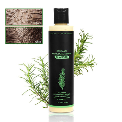 💕Father's Day Flash Sale 70%OFF Ends Soon!👑Organic Rosemary Hair Growth Shampoo