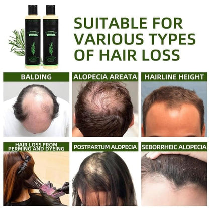 💕Father's Day Flash Sale 70%OFF Ends Soon!👑Organic Rosemary Hair Growth Shampoo