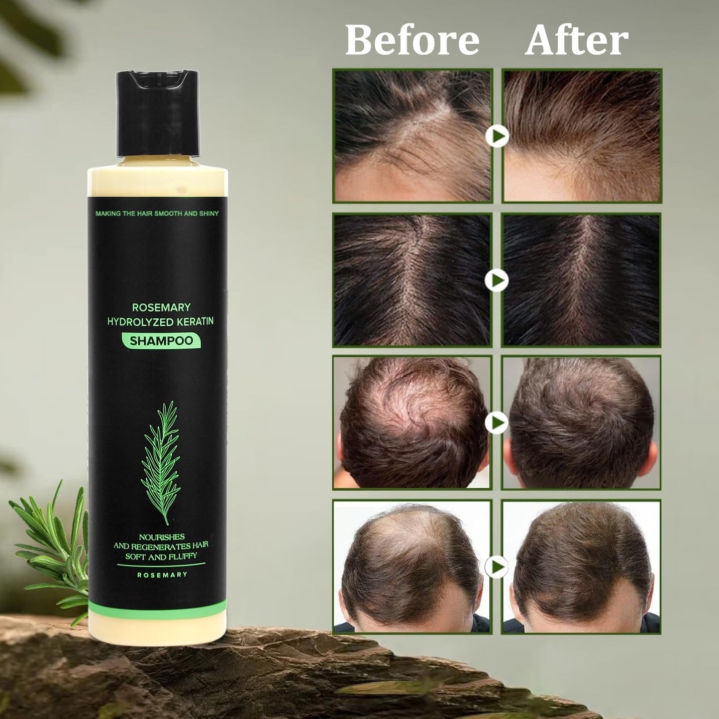 💕Father's Day Flash Sale 70%OFF Ends Soon!👑Organic Rosemary Hair Growth Shampoo